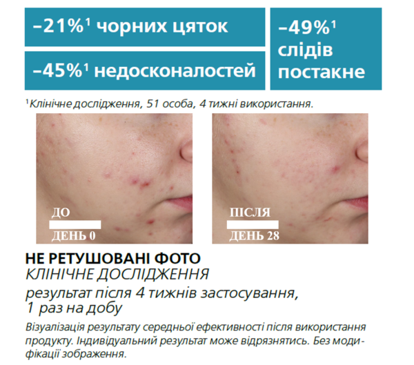 Ультраконцентрированная сыворотка La Roche-Posay Effaclar, с эффектом пилинга и комплексом трех кислот, для жирной проблемной кожи, 30 мл - Pampik - 5