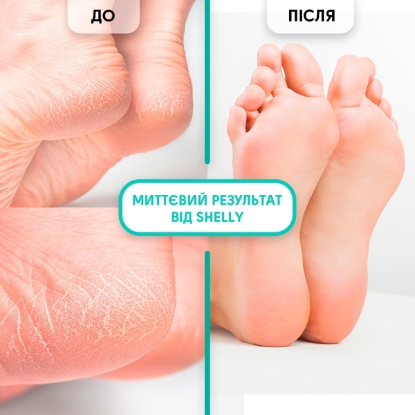 Гель-кератолитик для удаления мозолей и натоптышей Shelly Мягкое лезвие, 200 мл - Pampik - 5