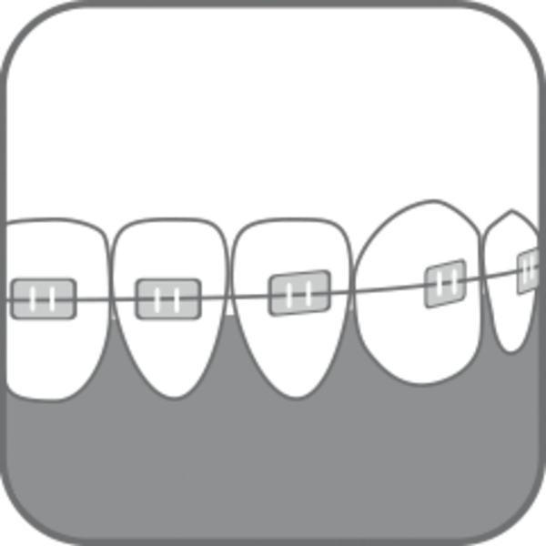 Дитяча зубна щітка Paro Swiss S27, з монопучковою насадкою, м'яка, салатова. - Pampik - 5