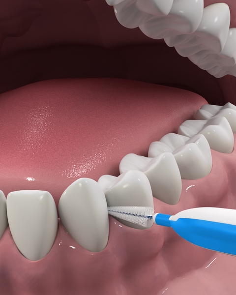 Міжзубна щітка DenTek для широких проміжків Зручне очищення, 16 шт. - Pampik - 5