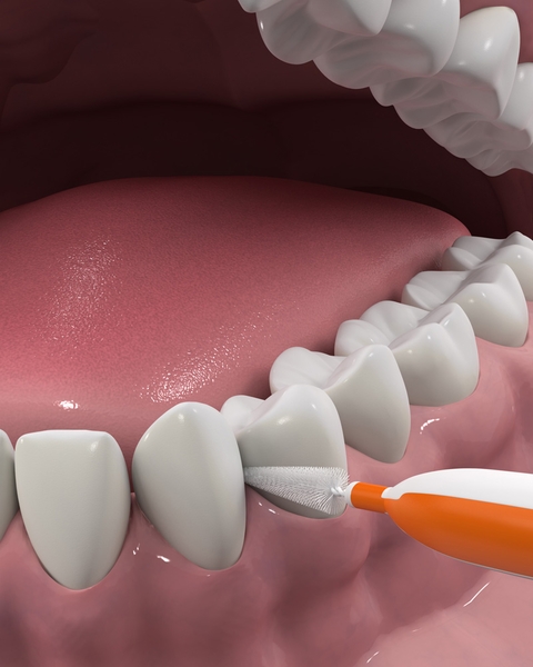 Міжзубна щітка DenTek для стандартних проміжків Зручне очищення, 16 шт. - Pampik - 6