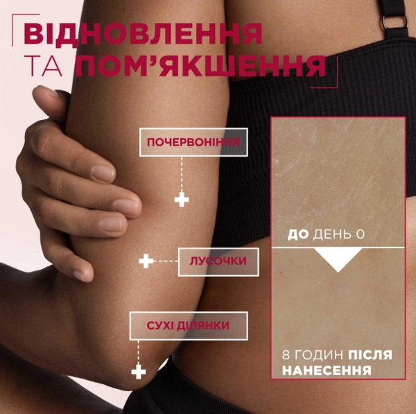 Крем Mixa Urea Cica Repair для сухої огрубілої шкіри обличчя рук і тіла відновлювальний 400 мл - Pampik - 6