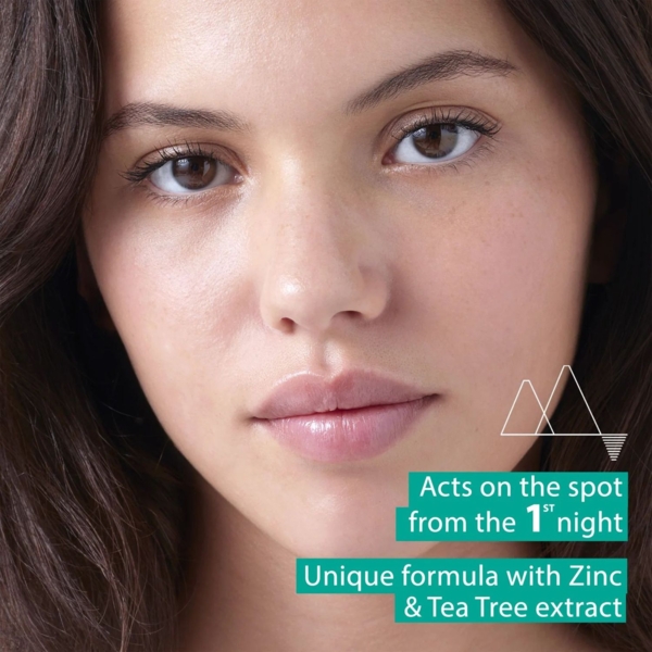 Паста від висипань Uriage Eau Thermale SOS-догляд для жирної та проблемної шкіри 15 мл - Pampik - 4