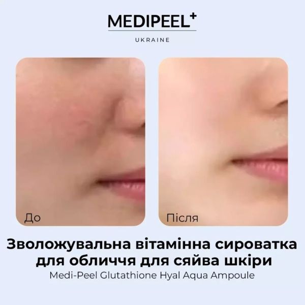 Сыворотка для лица Medi-Peel Glutathione Hyal Aqua Ampoule увлажняющая витаминная для сияния кожи 30 мл - Pampik - 5