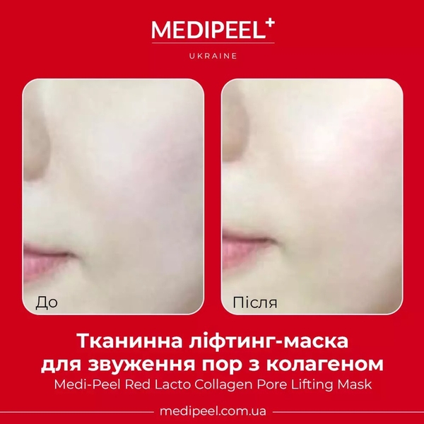 Тканевая лифтинг-маска Medi Peel Red Lacto Collagen Pore Lifting Mask для сужения пор, с коллагеном, 30 мл - Pampik - 2