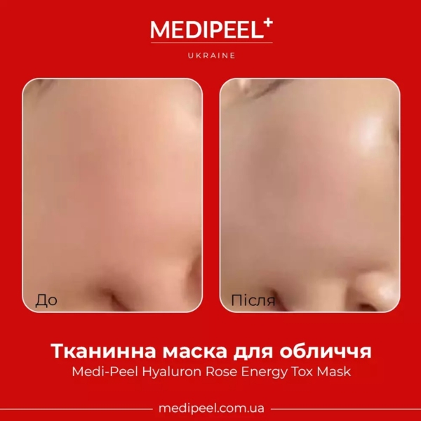 Тканевая маска для лица Medi-Peel Hyaluron Rose Energy Tox Mask, 30 мл - Pampik - 2