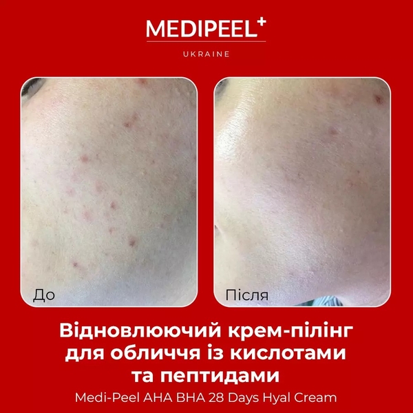 Крем-пілінг для обличчя Medi-Peel AHA BHA 28 Days Hyal Cream відновлювальний з кислотами та пептидами 30 мл - Pampik - 4