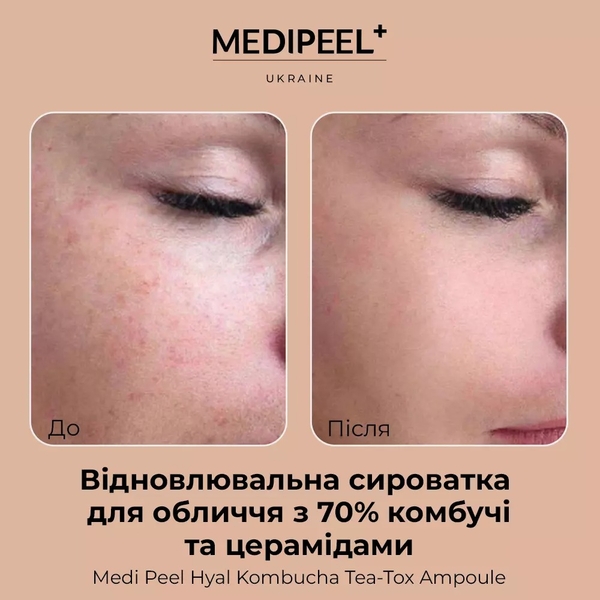 Сыворотка для лица Medi-Peel Hyal Kombucha Tea-Tox Ampoule восстановительная с 70% комбучи 50 мл - Pampik - 4