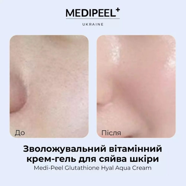Крем-гель для обличчя Medi-Peel Glutathione Hyal Aqua Cream зволожувальний вітамінний 50 мл - Pampik - 5