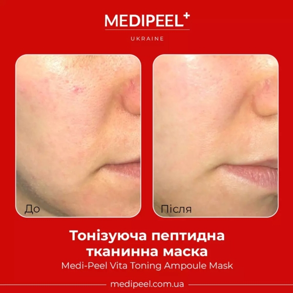 Тканинна маска для обличчя Medi-Peel Vita Toning Ampoule Mask тонізувальна ампульна 30 мл - Pampik - 3