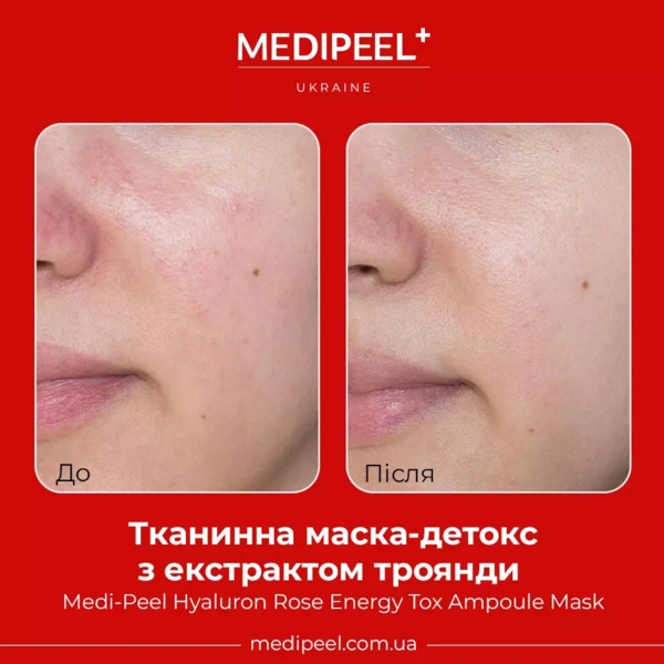 Тканевая маска-детокс Medi-Peel Hyaluron Rose Energy Tox Ampoule Mask с экстрактом розы 30 мл - Pampik - 4