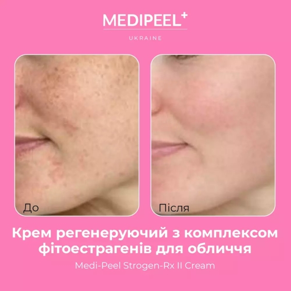 Крем для лица Medi-Peel Strogen-Rx II Cream регенерирующий с комплексом фитоэстрогенов 30 мл - Pampik - 3