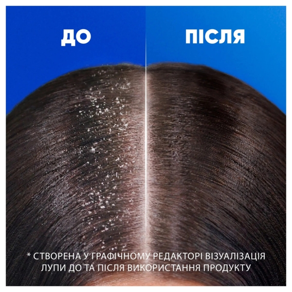 Шампунь проти лупи Head&Shoulders Зволожувальний догляд, 400 мл - Pampik - 4