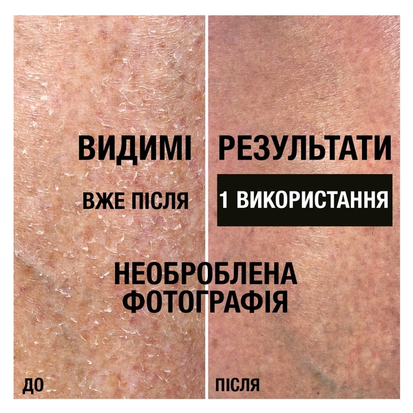 Лосьон для тела Neutrogena Норвежская формула Интенсивное восстановление, 250 мл - Pampik - 6