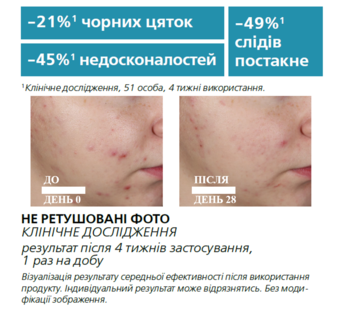 Ультраконцентрированная сыворотка La Roche-Posay Effaclar, с эффектом пилинга и комплексом трех кислот, для жирной проблемной кожи, 30 мл - Pampik - 5