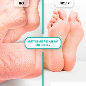 Гель-кератолитик для удаления мозолей и натоптышей Shelly Мягкое лезвие, 200 мл - Pampik - 5