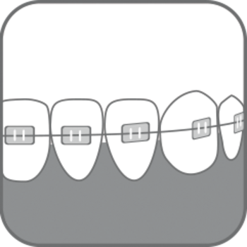 Дитяча зубна щітка Paro Swiss S27, з монопучковою насадкою, м'яка, рожевий - Pampik - 4