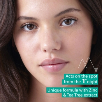 Паста від висипань Uriage Eau Thermale SOS-догляд для жирної та проблемної шкіри 15 мл - Pampik - 4