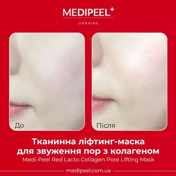 Тканевая лифтинг-маска Medi Peel Red Lacto Collagen Pore Lifting Mask для сужения пор, с коллагеном, 30 мл - Pampik - 2