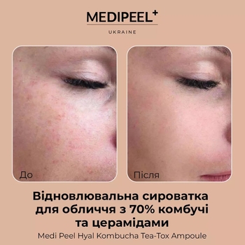 Сыворотка для лица Medi-Peel Hyal Kombucha Tea-Tox Ampoule восстановительная с 70% комбучи 50 мл - Pampik - 4