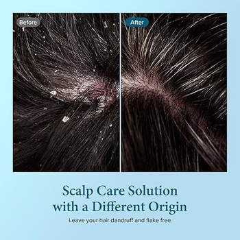 Шампунь Kundal Dandruff Relief Shampoo White Musk для сухой кожи головы с ароматом белого мускуса 500 мл - Pampik - 6