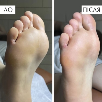 Пенка для размягчения ороговевшей кожи на стопах PNB PedicureFoam 150 мл - Pampik - 3