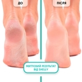 Пінний експрес-розм'якшувач для педикюру Shelly М'яке лезо, 150 мл - Pampik - 4