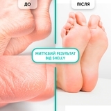 Гель-кератолитик для удаления мозолей и натоптышей Shelly Мягкое лезвие, 200 мл - Pampik - 5