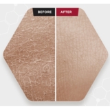 Сыворотка для лица SKIN1004 Zombie Beauty By Bloody Peel с кислотами 30 мл - Pampik - 4