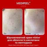 Крем-пілінг для обличчя Medi-Peel AHA BHA 28 Days Hyal Cream відновлювальний з кислотами та пептидами 30 мл - Pampik - 4