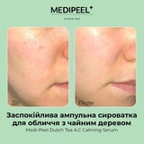 Сыворотка ампульная для лица Medi-Peel Dutch Tea AC Calming Serum с чайным деревом 70 мл - Pampik - 4