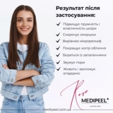 Тканевая маска-детокс Medi-Peel Hyaluron Rose Energy Tox Ampoule Mask с экстрактом розы 30 мл - Pampik - 6