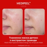 Тканевая маска-детокс Medi-Peel Hyaluron Rose Energy Tox Ampoule Mask с экстрактом розы 30 мл - Pampik - 4